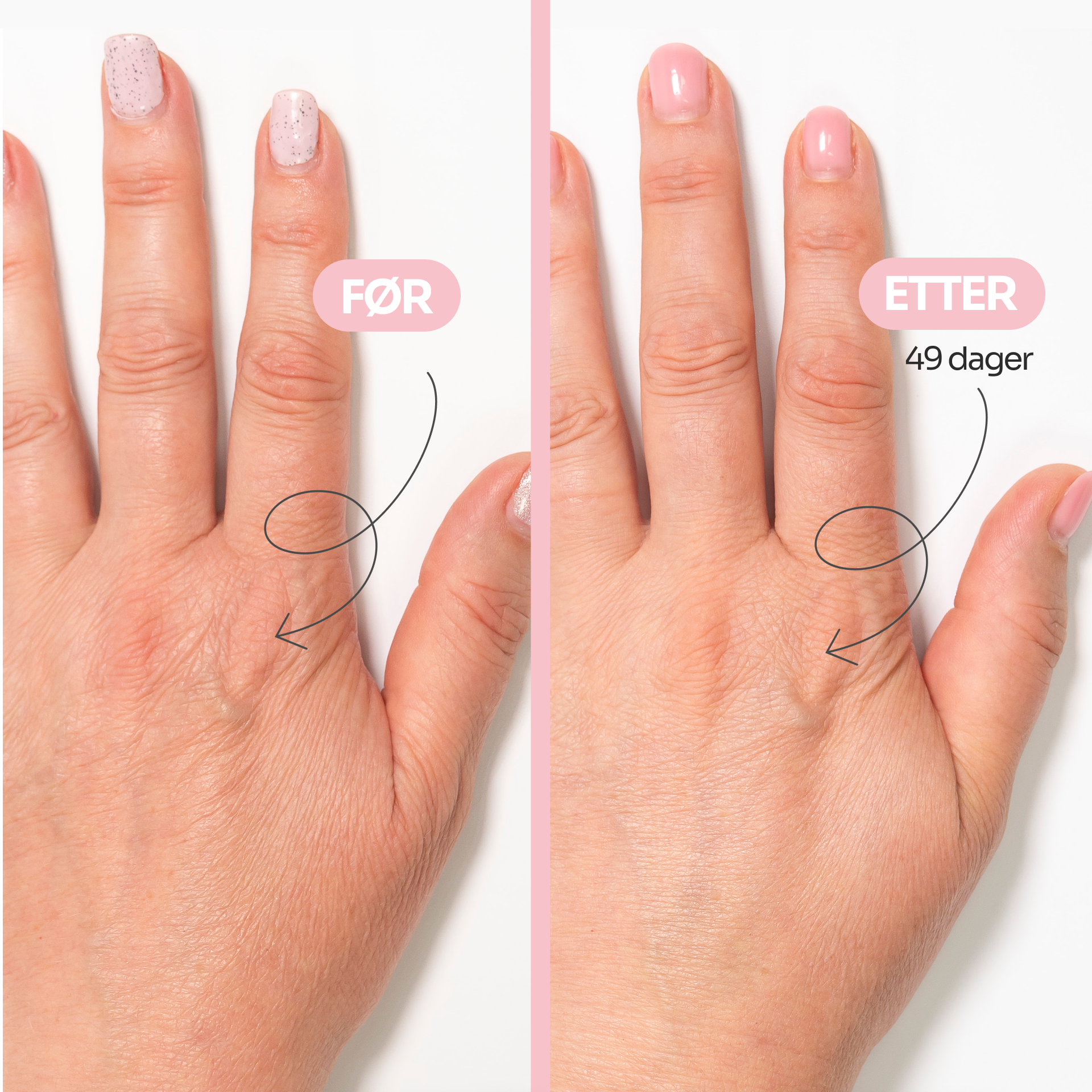 AGE-DEFYING hand cream